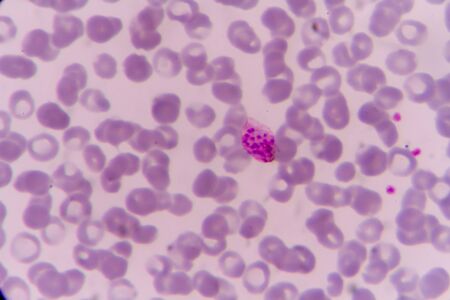 plasmodium vivax mature schizont  statの写真素材