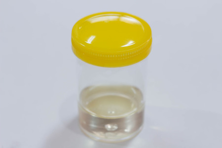 Urine sample  in laboratory