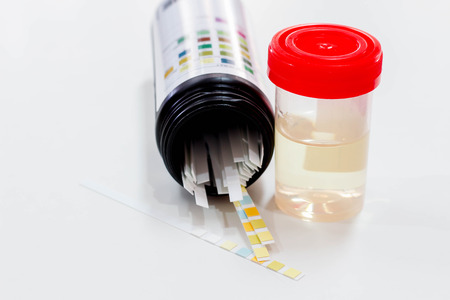 Urine sample with reagent strip test urinalysis in laboratoryの写真素材