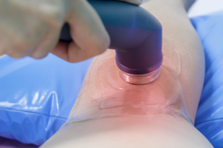 Physiotherapists treat patients with medical instruments.