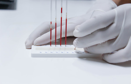 blood sample for hematocrit testingの写真素材