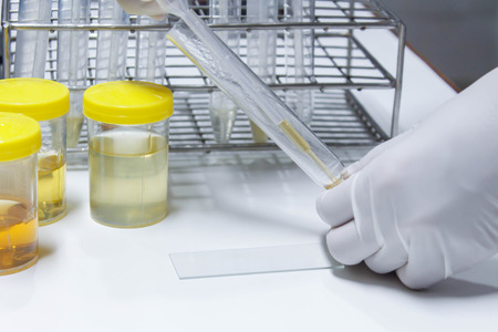 Urine sampleの写真素材