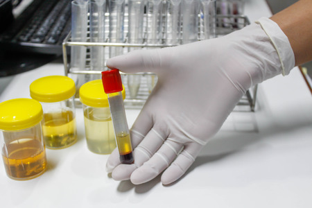 hand holding tube blood sample in labolatoryの写真素材