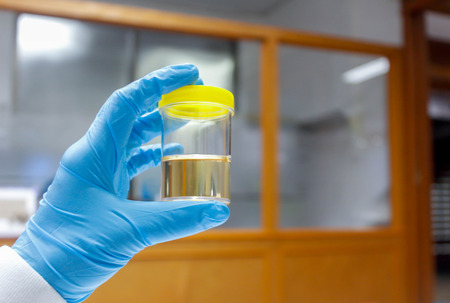 Doctor holding Urine sample in laboratoryの写真素材