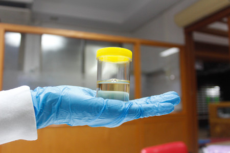 Doctor holding Urine sample in laboratory