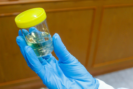 Doctor holding Urine sample in laboratory