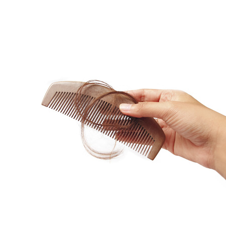 Hair loss problemの写真素材