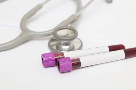 test tube of blood and stethoscopeの写真素材