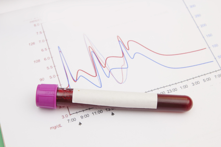 Form the results of biochemistry blood testsの写真素材