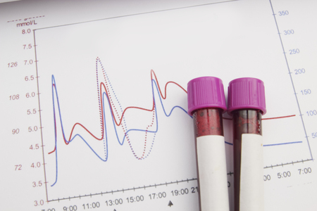 Form the results of biochemistry blood testsの写真素材