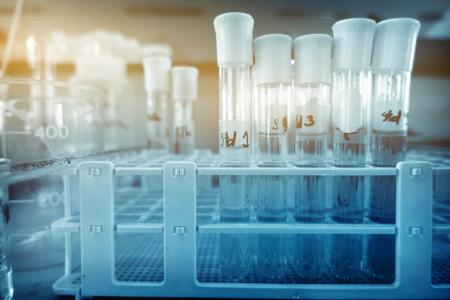  laboratory test tube with soft focusの写真素材