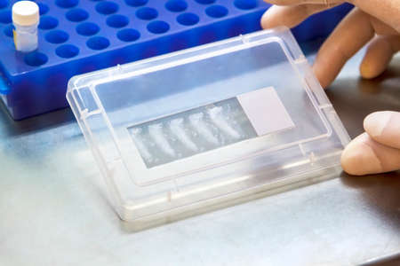 hands of a scientist in white gloves holding a slide with paraffin slices containing samples of...