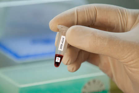 hand holding a blood test tube, blood sampling to check for the presence of coronavirus 2019-nCoVの写真素材