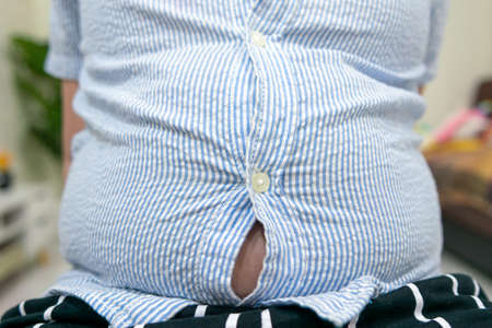 Tight shirt of obese fat boy overweight.