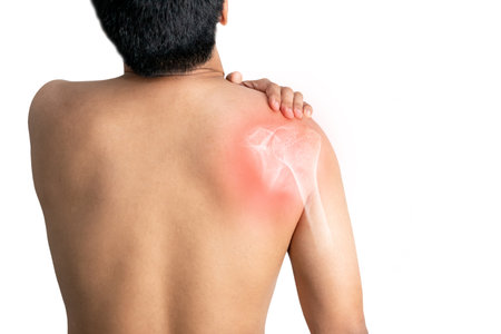 Inflammation of the muscles and bones of the armの写真素材