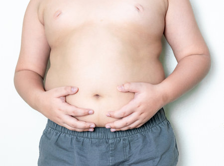 Obese children, overweight, obesity and belly fatの写真素材