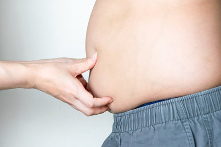 Obese children, overweight, obesity and belly fatの写真素材
