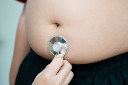 Stethoscope concept of fat children with bellyの写真素材