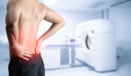 Man has pain and inflammation in his back and CT scan.の写真素材