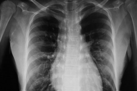 Black and white torso X-ray film imageの写真素材