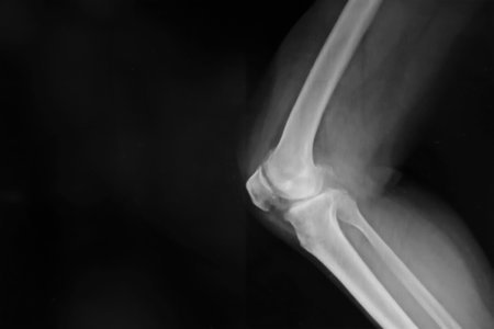 Black and white X-ray film of the knee and leg.の写真素材