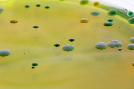 Closeup for plate Bacteria culture growth on Selective media in Microbiology room at Laboratory,...