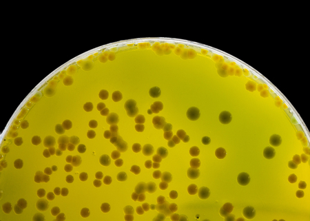 Closeup for plate Bacteria culture growth on Selective media in Microbiology room at Laboratory,...