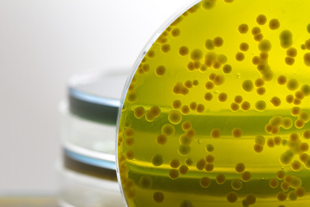 Closeup for plate Bacteria culture growth on Selective media in Microbiology room at Laboratory, vibrio sppの写真素材