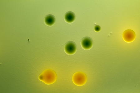 Closeup for plate Bacteria culture growth on Selective media in Microbiology room at Laboratory,...