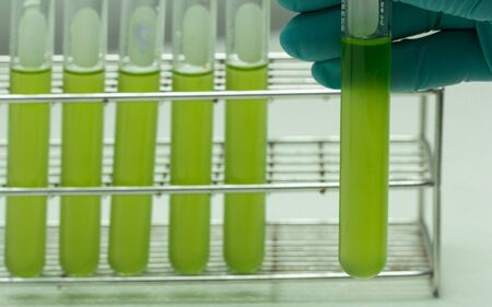 Marine plankton or Microalgae culture into a test tube in laboratory, Green algae or phytoplankton...