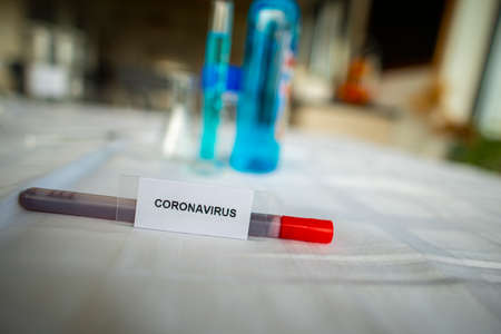 Laboratory test for Coronavirusの写真素材
