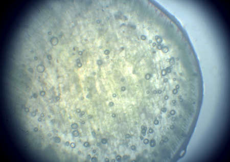 microscope photo of plant cell