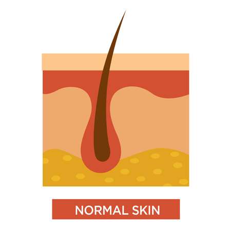 Normal healthy skin structure with body hairのイラスト素材