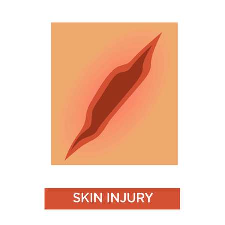 Medicine skin injury scratch or cut vector treatment and healthcare broken epithelial tissue human trauma infection prevention hole or rupture disinfection medical problem isolated body part.のイラスト素材