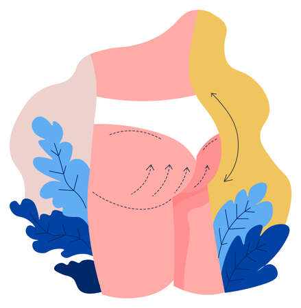 Buttocks lifting cellulite removal, body reshapingのイラスト素材