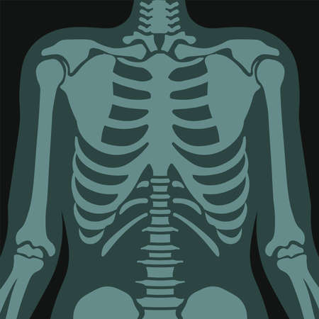 X ray of lungs and ribs, healthcare scan vector