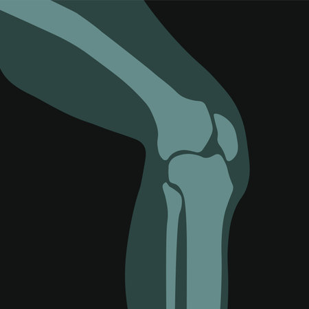 Xray of knee joint, roentgen scan of human bodyのイラスト素材