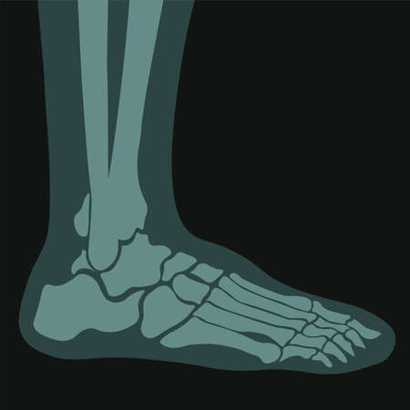 Xray of foot, joints and bones roentgen scansのイラスト素材