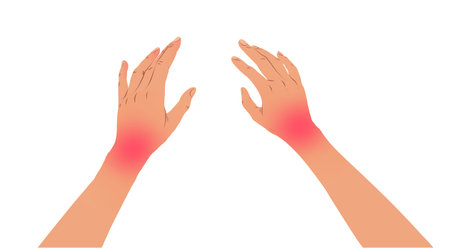 Hands with carpal tunnel syndromeのイラスト素材