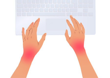 Hands with carpal tunnel syndromeのイラスト素材