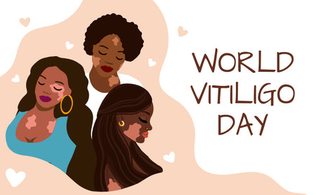 World Vitiligo Day Vector Banner. posterのイラスト素材
