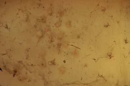 Dry spiders and cocoons in thick web.
