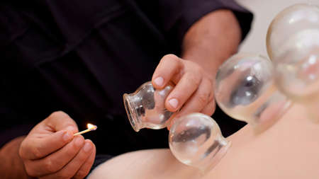 Chinese cupping.  Cupping increases blood circulation to the area where the cups are placed. This...