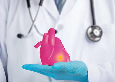 A cardiologist holding a 3d model heart with an infarction spot.  Myocardial infarction, emergency medicine concept.の写真素材