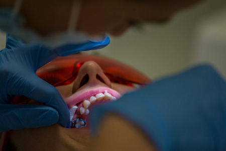 Getting braces in the orthodontics officeの写真素材