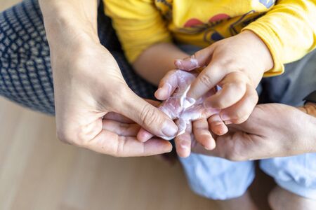 Mother applying white cream for burned hand of her little sonの写真素材