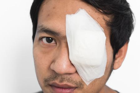 White medicine plaster patch on the eye after treatment stye eyeの写真素材
