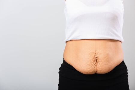 Close up of Asian mother woman showing stretch mark loose lower abdomen skin she fat after pregnancy baby birth, studio isolated on white background, Healthy belly overweight excess body conceptの写真素材