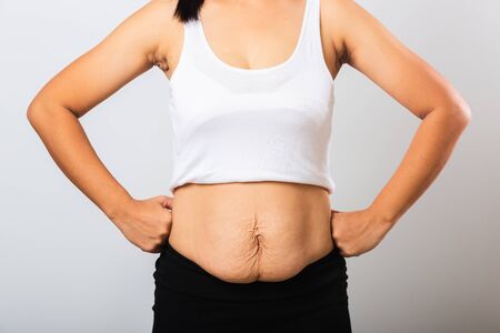 Close up of Asian mother woman showing stretch mark loose lower abdomen skin she fat after pregnancy baby birth, studio isolated on white background, Healthy belly overweight excess body conceptの写真素材