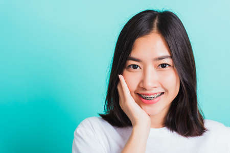 Portrait of Asian teen beautiful young woman smile have dental braces on teeth laughing she touching her face by hand, studio shot isolated on a blue background, Medicine and dentistry conceptの写真素材